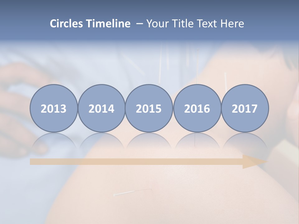 A Woman Getting Acupulations On Her Back With Needles PowerPoint Template