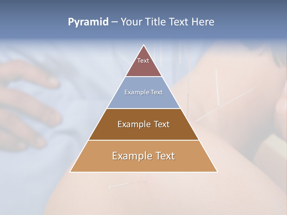 A Woman Getting Acupulations On Her Back With Needles PowerPoint Template