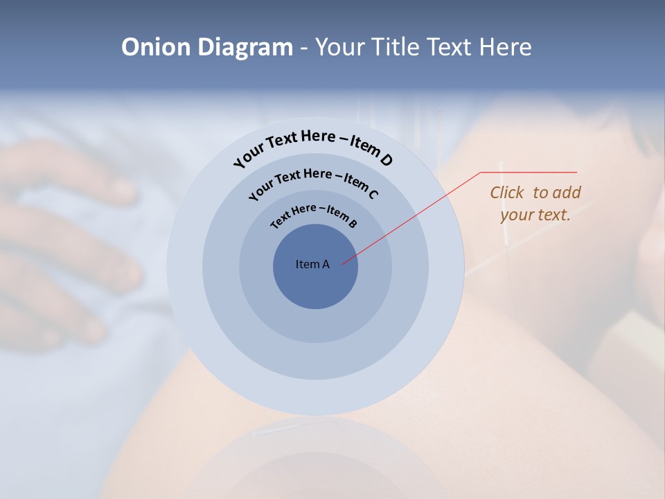 A Woman Getting Acupulations On Her Back With Needles PowerPoint Template