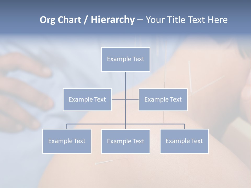 A Woman Getting Acupulations On Her Back With Needles PowerPoint Template