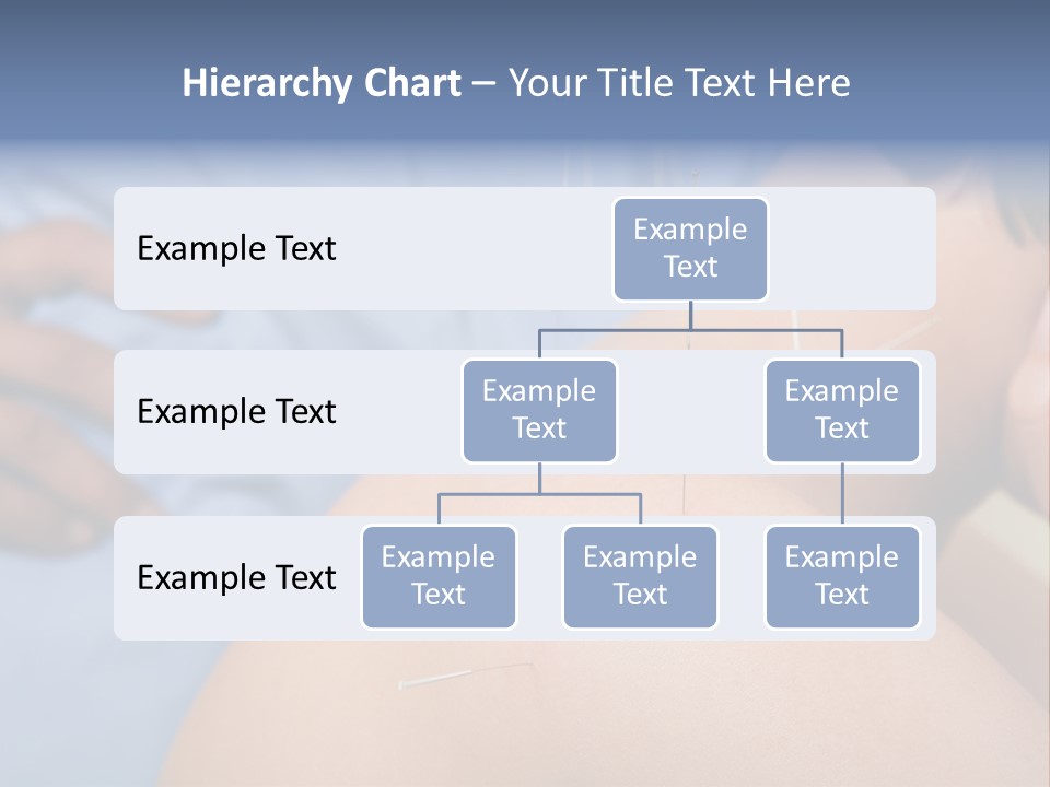 A Woman Getting Acupulations On Her Back With Needles PowerPoint Template