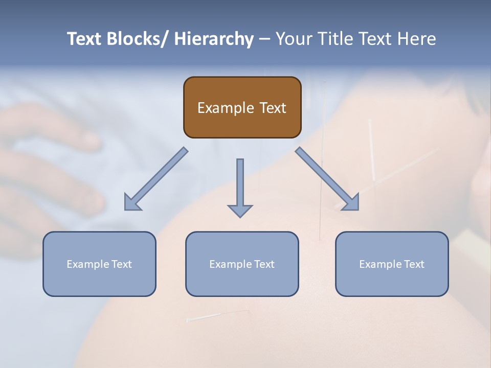 A Woman Getting Acupulations On Her Back With Needles PowerPoint Template
