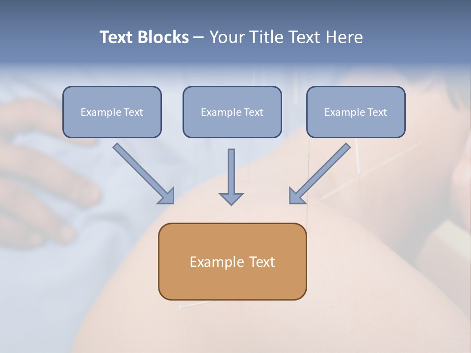 A Woman Getting Acupulations On Her Back With Needles PowerPoint Template