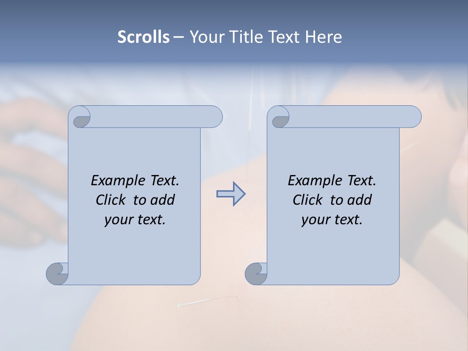 A Woman Getting Acupulations On Her Back With Needles PowerPoint Template