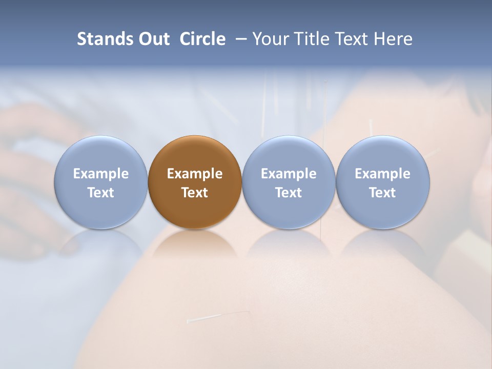 A Woman Getting Acupulations On Her Back With Needles PowerPoint Template