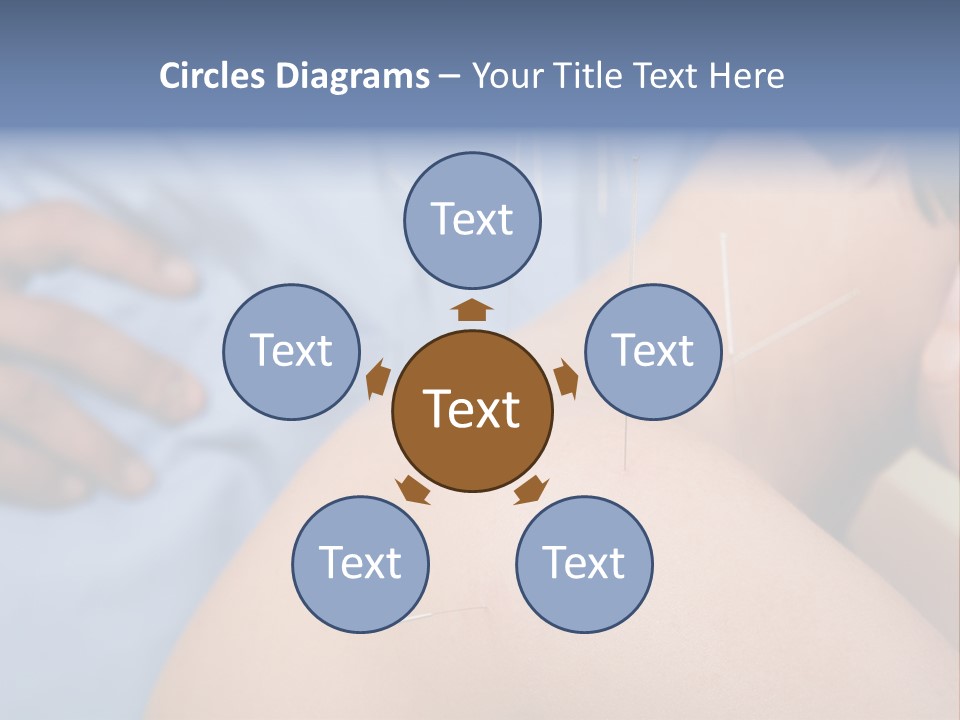 A Woman Getting Acupulations On Her Back With Needles PowerPoint Template