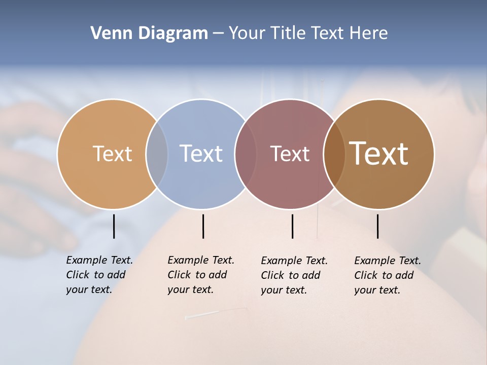 A Woman Getting Acupulations On Her Back With Needles PowerPoint Template