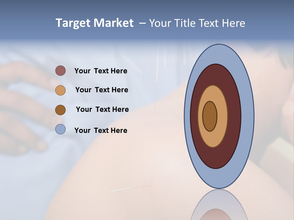 A Woman Getting Acupulations On Her Back With Needles PowerPoint Template