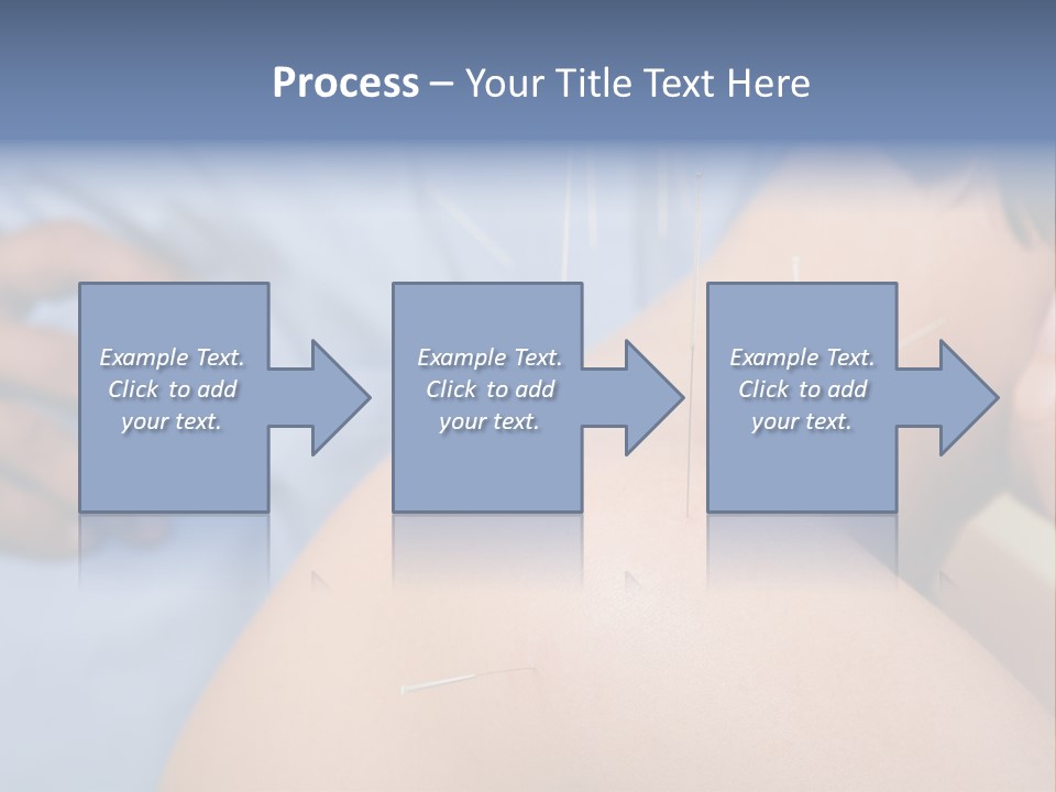 A Woman Getting Acupulations On Her Back With Needles PowerPoint Template