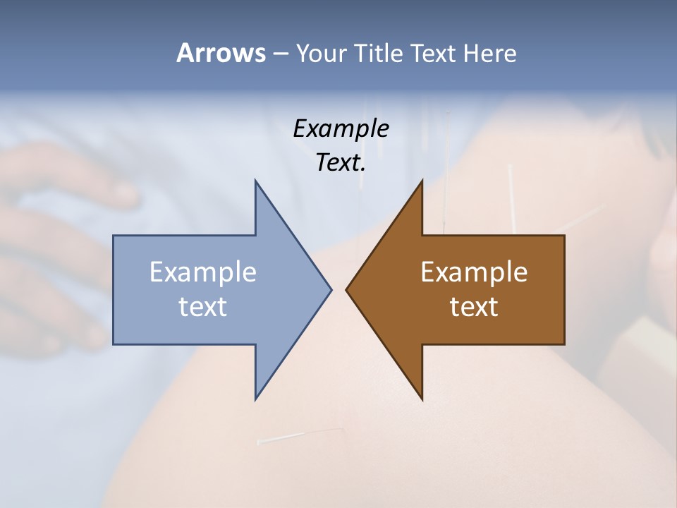 A Woman Getting Acupulations On Her Back With Needles PowerPoint Template