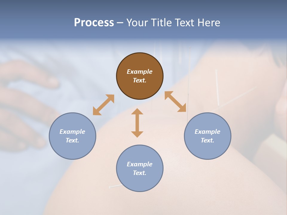 A Woman Getting Acupulations On Her Back With Needles PowerPoint Template