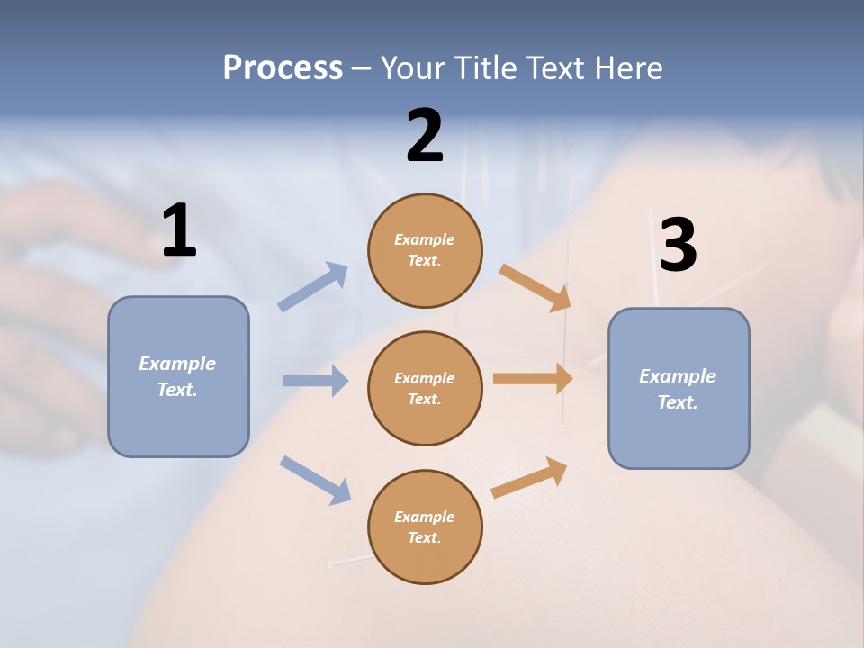 A Woman Getting Acupulations On Her Back With Needles PowerPoint Template