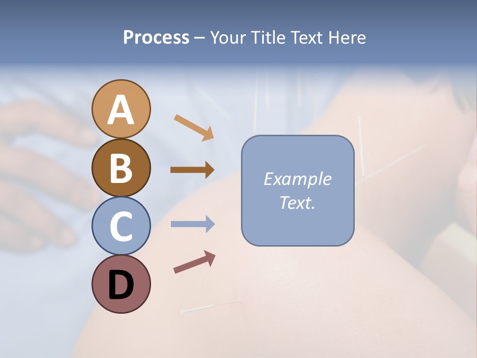 A Woman Getting Acupulations On Her Back With Needles PowerPoint Template