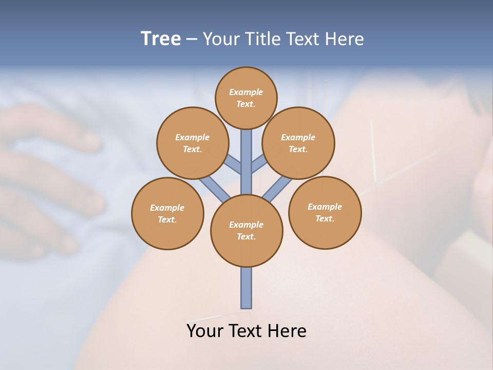 A Woman Getting Acupulations On Her Back With Needles PowerPoint Template