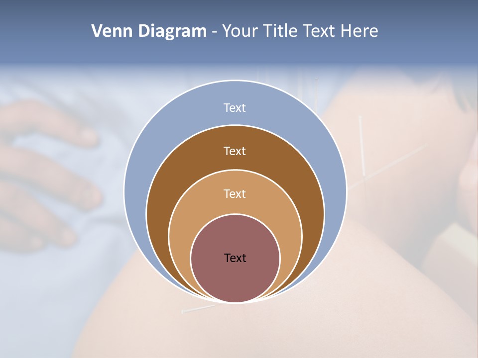A Woman Getting Acupulations On Her Back With Needles PowerPoint Template