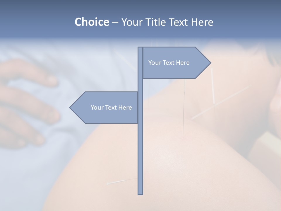 A Woman Getting Acupulations On Her Back With Needles PowerPoint Template