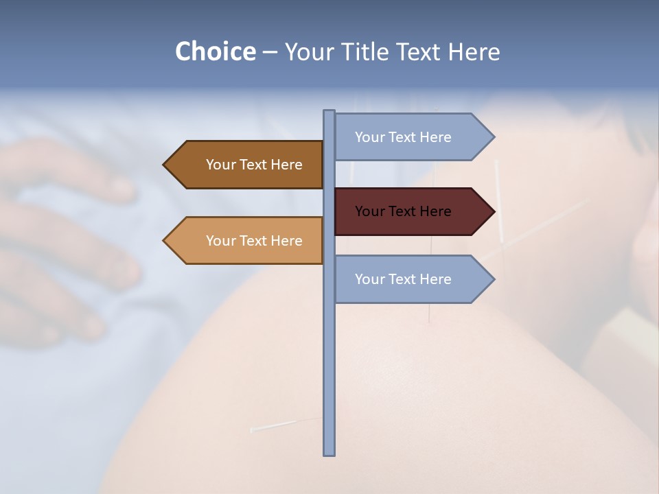 A Woman Getting Acupulations On Her Back With Needles PowerPoint Template