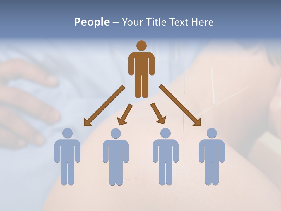 A Woman Getting Acupulations On Her Back With Needles PowerPoint Template