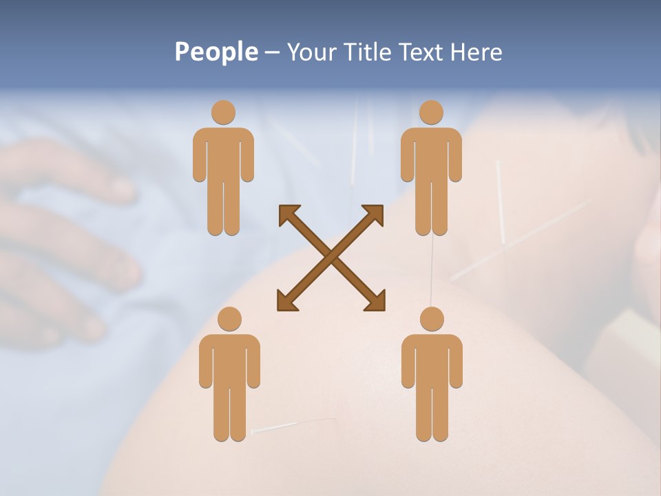 A Woman Getting Acupulations On Her Back With Needles PowerPoint Template