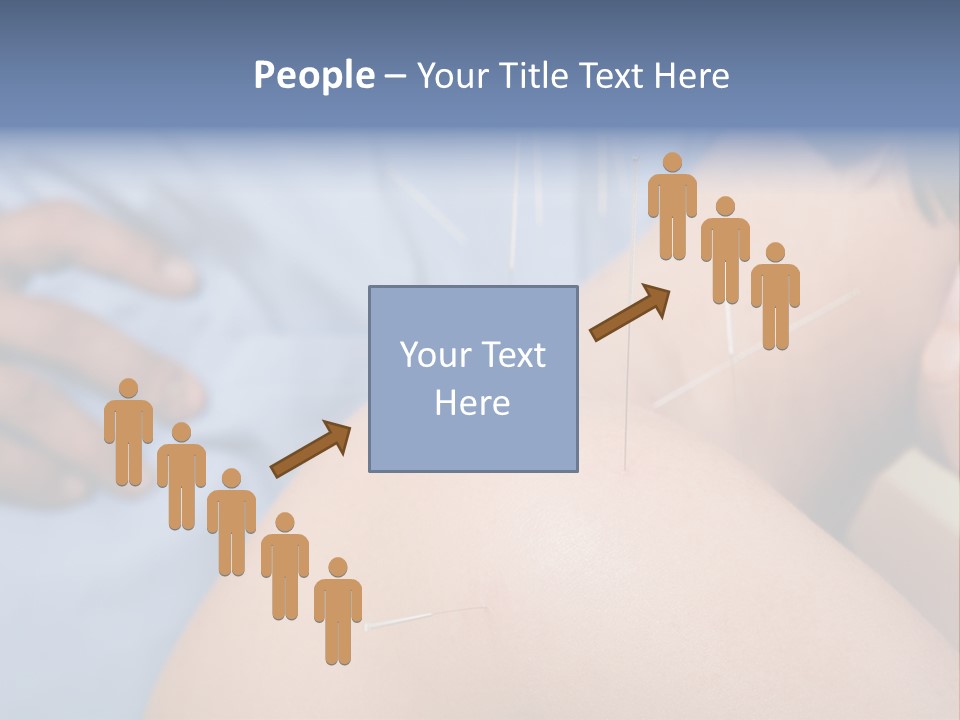 A Woman Getting Acupulations On Her Back With Needles PowerPoint Template