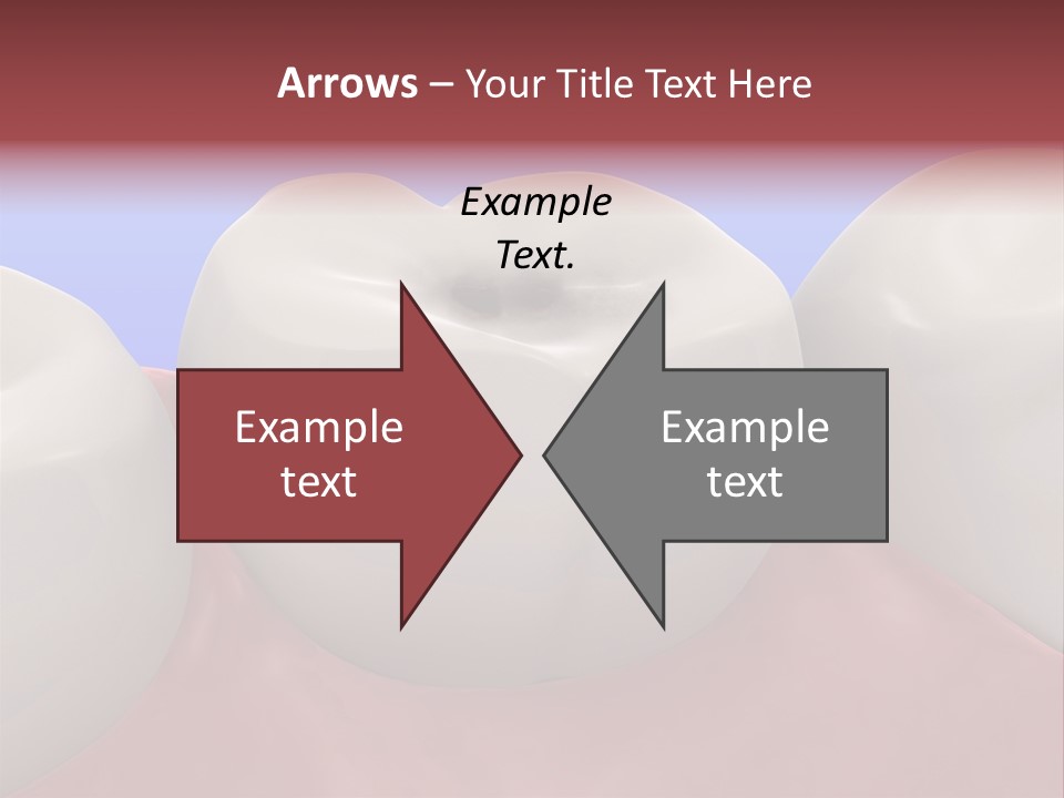 Caries PowerPoint Template