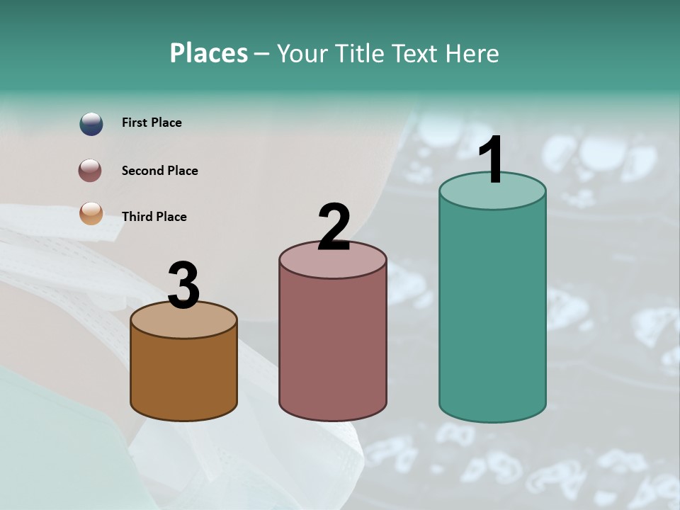 Doctor Is Looking At A X-Ray PowerPoint Template