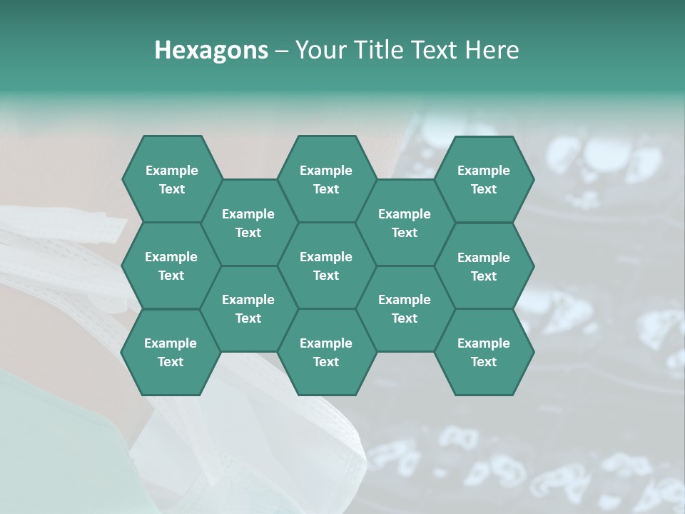 Doctor Is Looking At A X-Ray PowerPoint Template