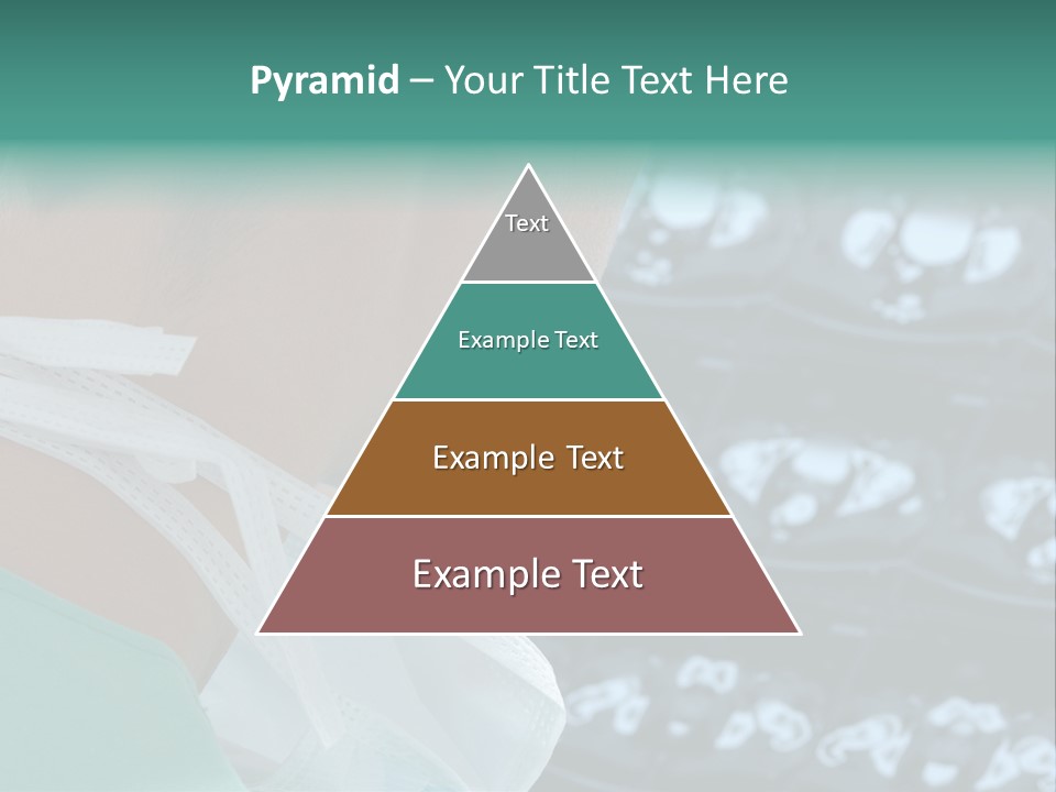 Doctor Is Looking At A X-Ray PowerPoint Template
