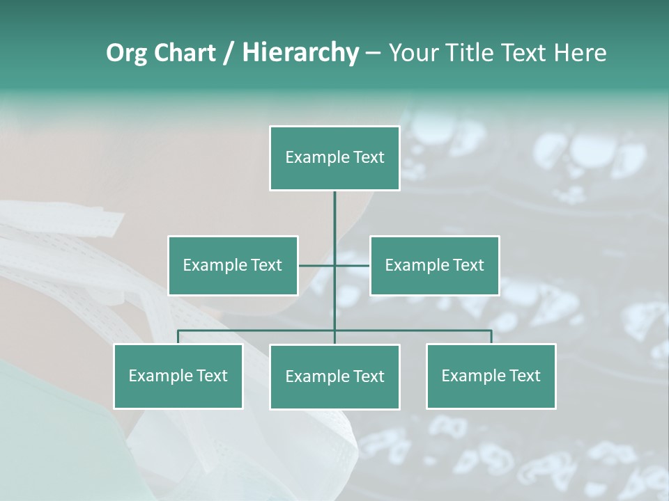Doctor Is Looking At A X-Ray PowerPoint Template