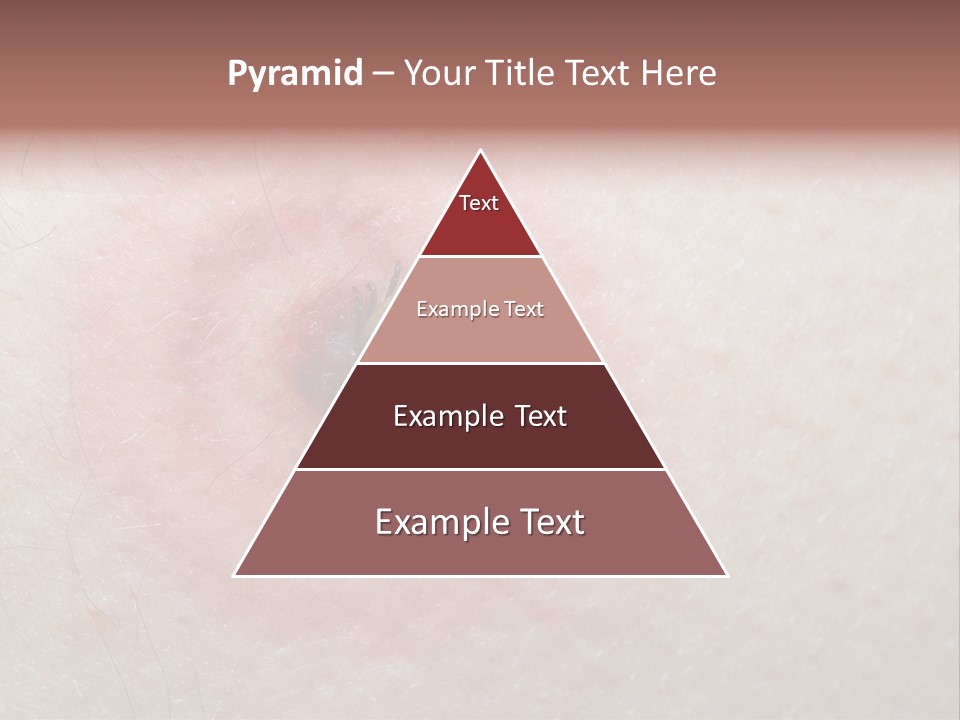 Tick On Skin PowerPoint Template