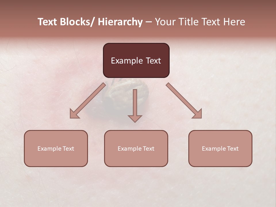 Tick On Skin PowerPoint Template
