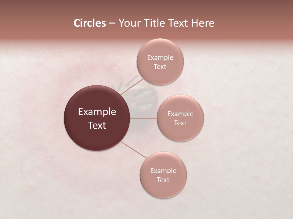 Tick On Skin PowerPoint Template