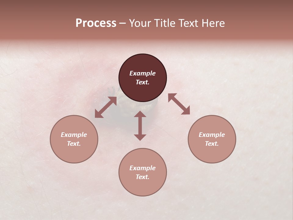 Tick On Skin PowerPoint Template