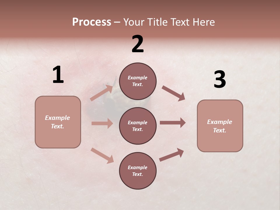 Tick On Skin PowerPoint Template