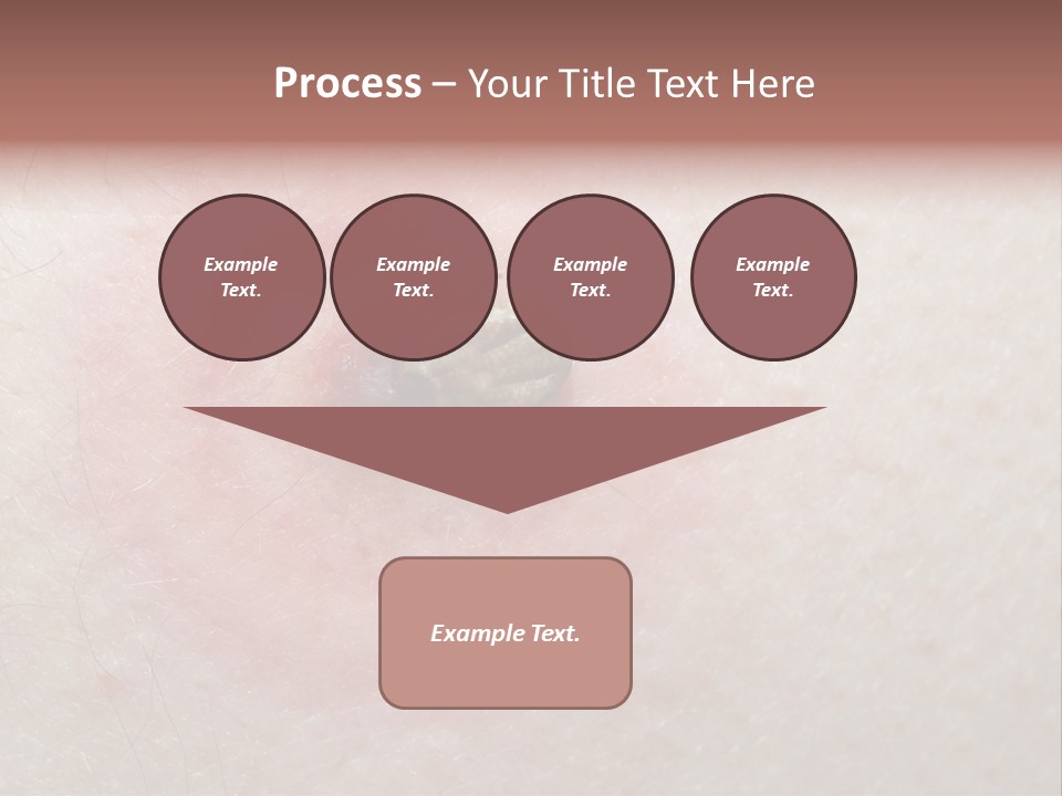 Tick On Skin PowerPoint Template