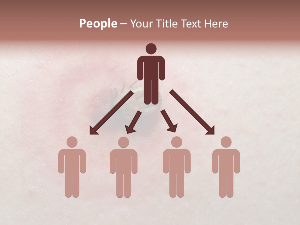 Tick On Skin PowerPoint Template