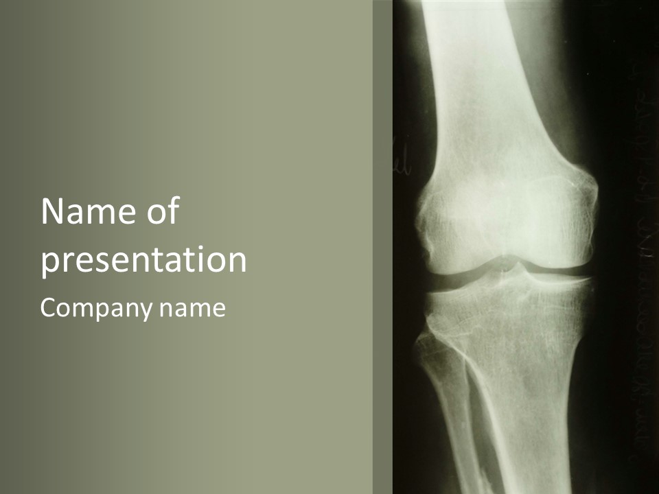 X-Ray Picture Of The Knee PowerPoint Template