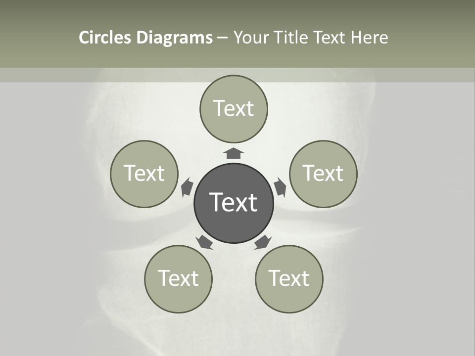 X-Ray Picture Of The Knee PowerPoint Template