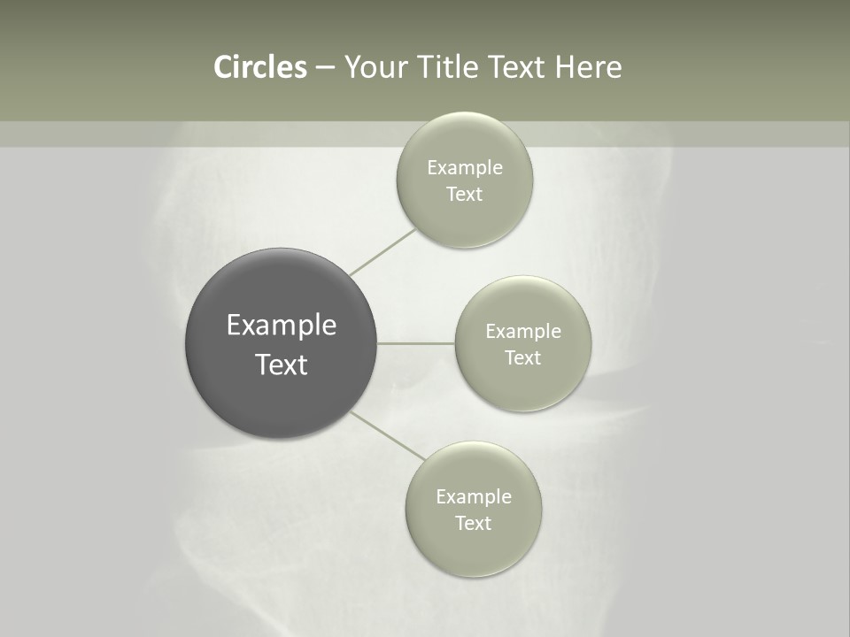 X-Ray Picture Of The Knee PowerPoint Template