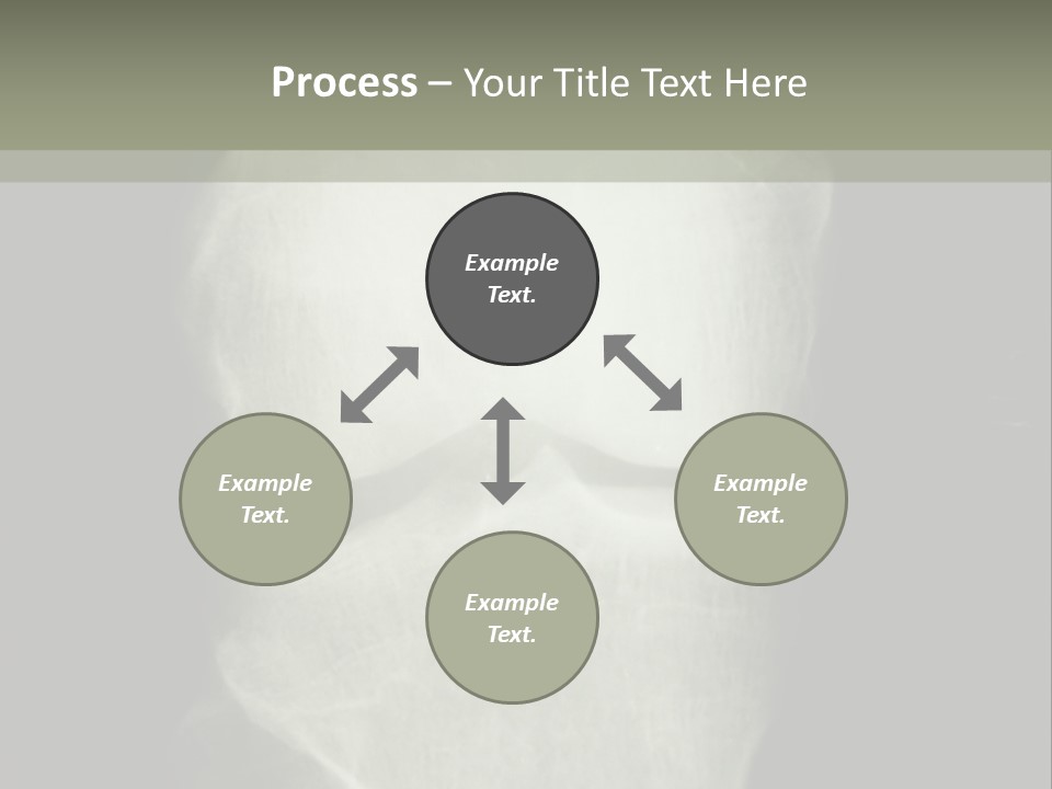 X-Ray Picture Of The Knee PowerPoint Template