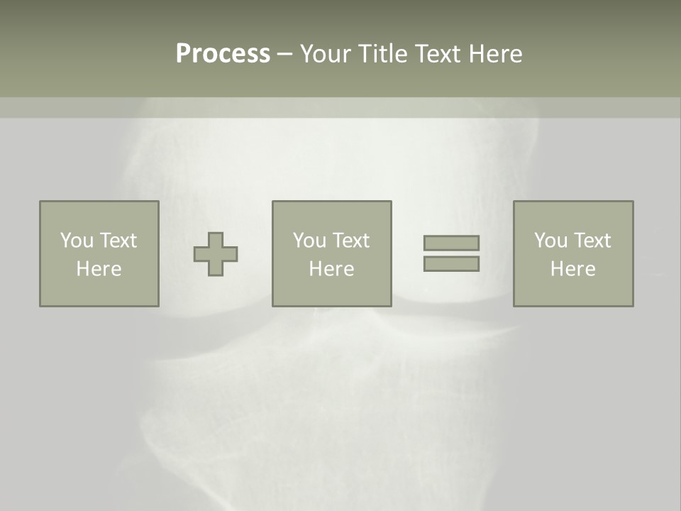 X-Ray Picture Of The Knee PowerPoint Template