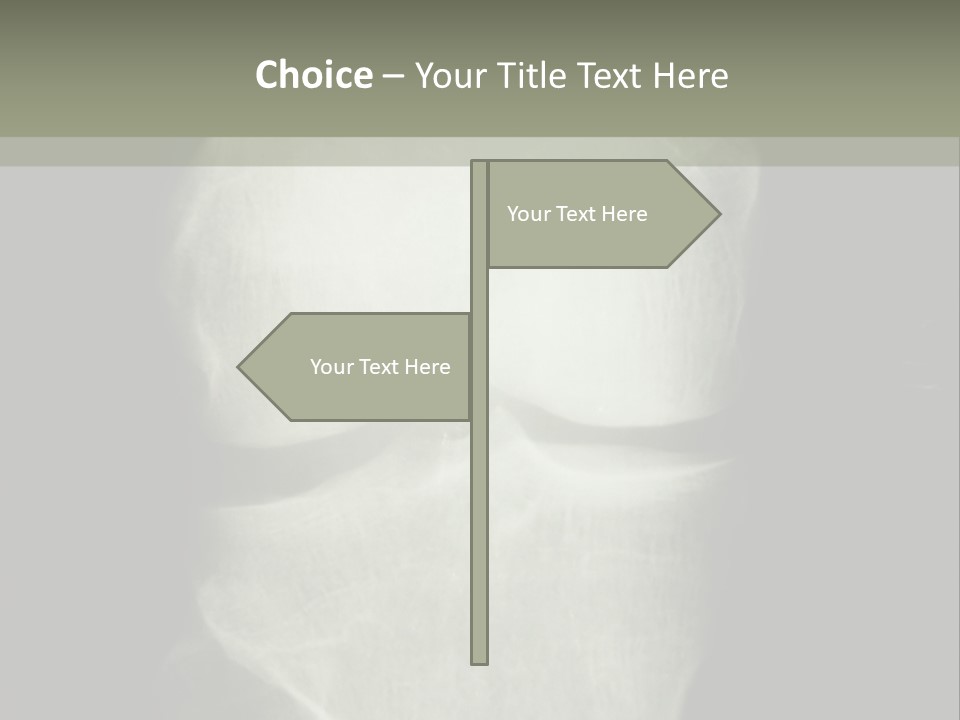 X-Ray Picture Of The Knee PowerPoint Template