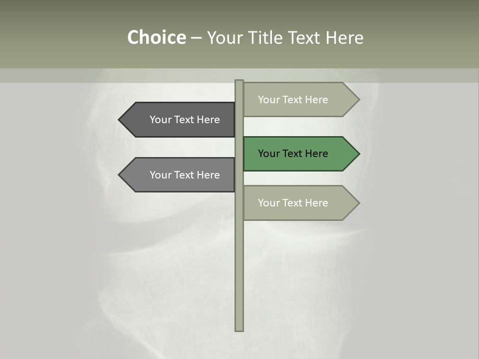 X-Ray Picture Of The Knee PowerPoint Template