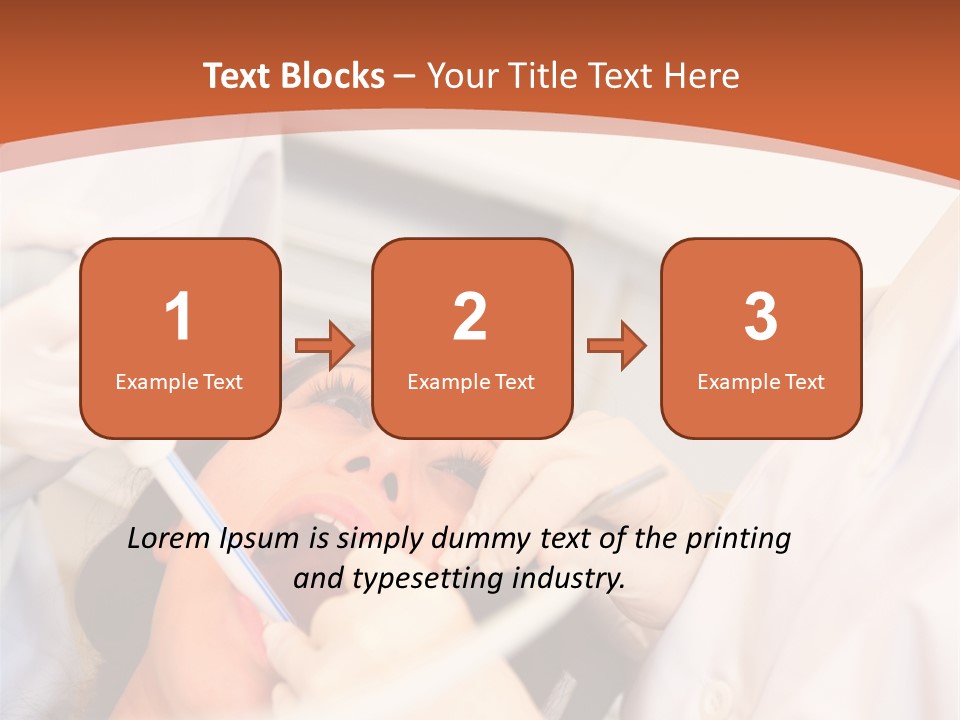 Interior Detail Of Crown Molding On Beams PowerPoint Template