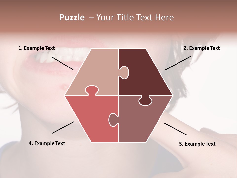 Pimple PowerPoint Template