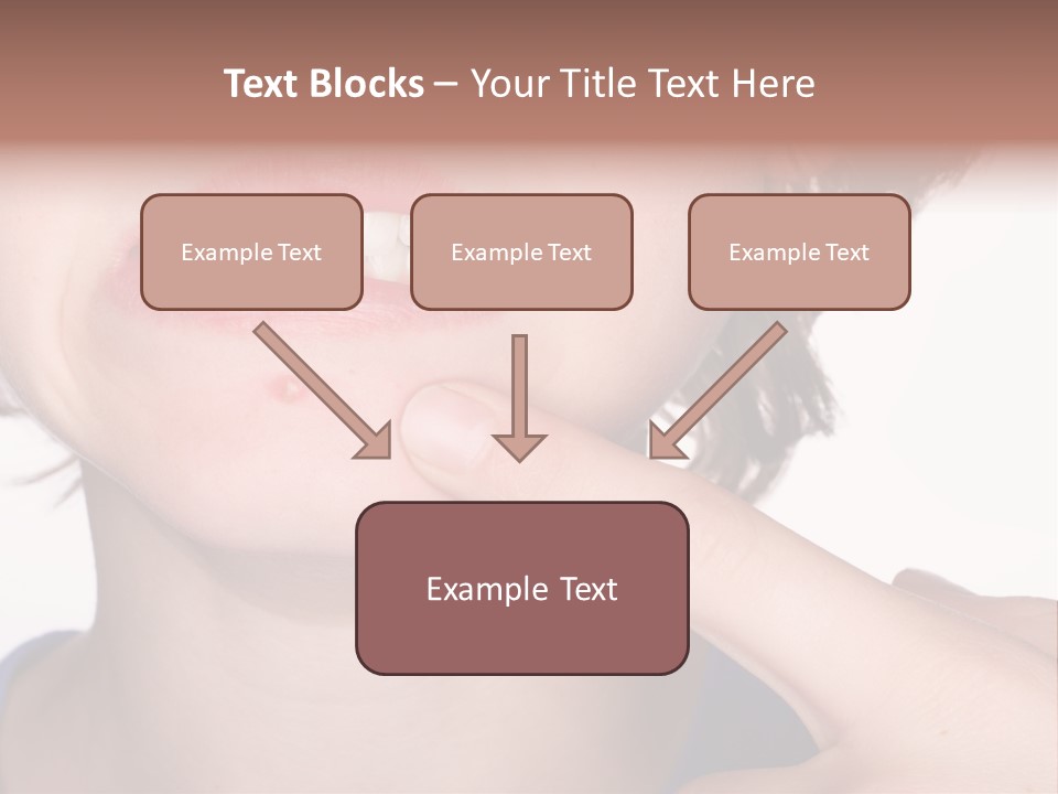 Pimple PowerPoint Template