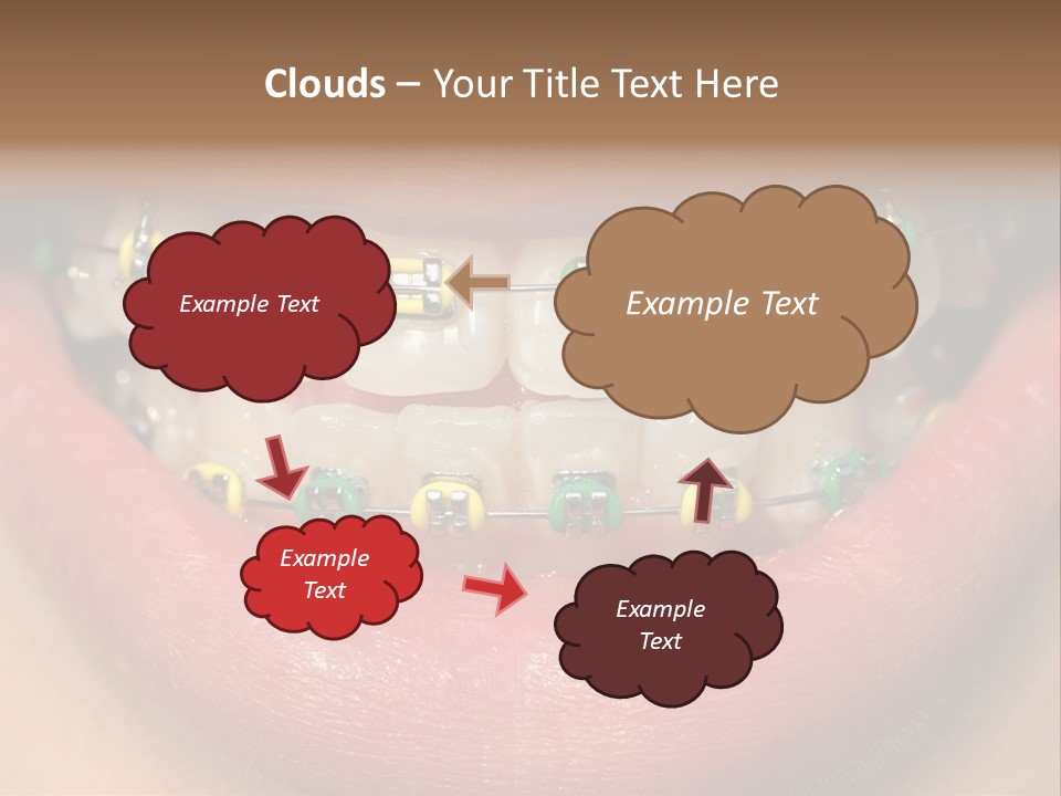 Colorful Braces PowerPoint Template
