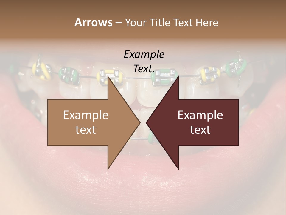 Colorful Braces PowerPoint Template