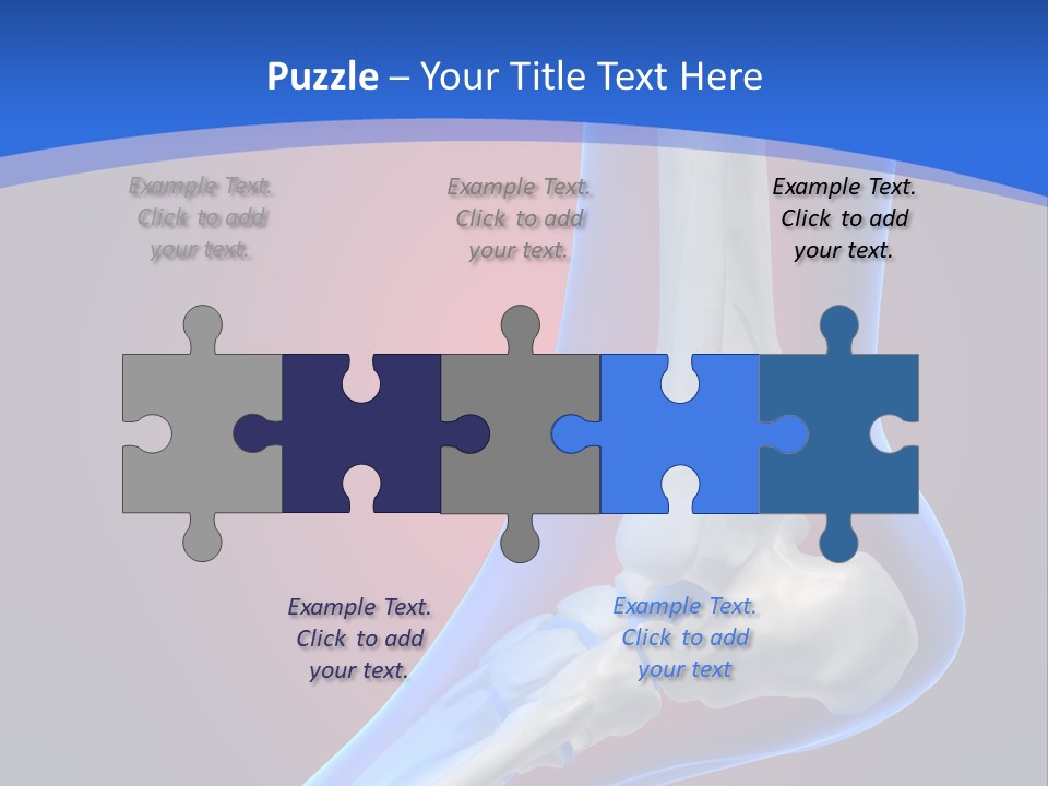 A Medical Powerpoint Presentation With A Skeleton PowerPoint Template