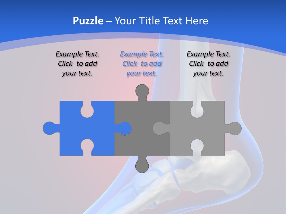 A Medical Powerpoint Presentation With A Skeleton PowerPoint Template